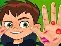 Trò chơi Bác sĩ tay Ben10  trực tuyến