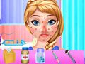 Trò chơi Điều trị dị ứng Anna Spring  trực tuyến