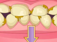 Trò chơi Bad Teeth Makeover trực tuyến