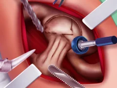 Trò chơi Princess Hips Surgery trực tuyến