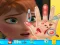 Trò chơi Anna hand doctor trực tuyến