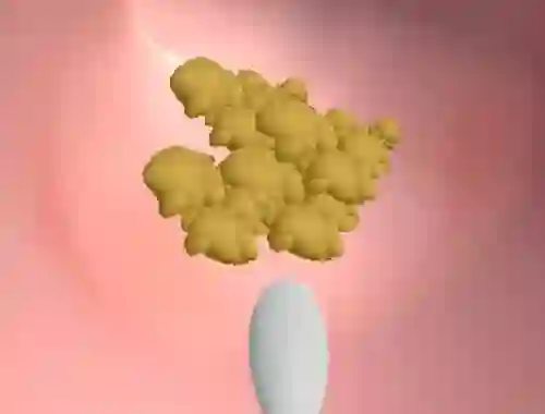 Trò chơi Earwax Clinic trực tuyến