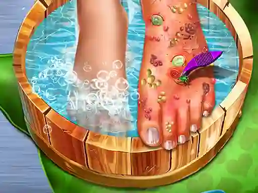 Trò chơi Feet Skin Doctor trực tuyến