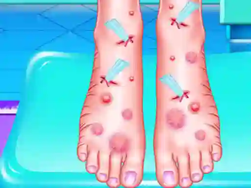 Trò chơi Emma Foot Treatment trực tuyến