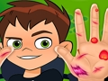 Trò chơi Bác sĩ tay Ben10  trực tuyến