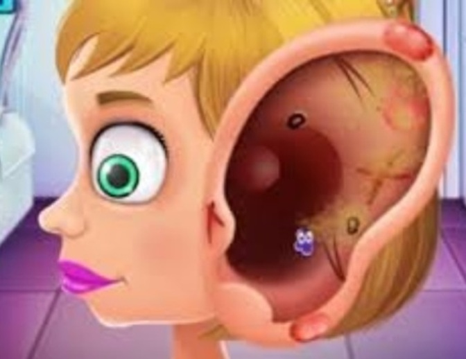 Trò chơi Bác sĩ trẻ em điều trị tai  trực tuyến